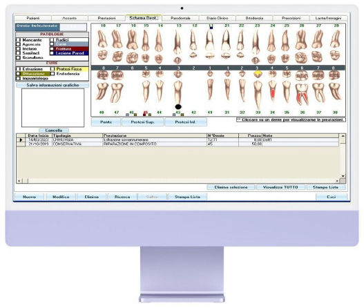 gestionale dentisti Schema dei denti con indicazioni per i lavori da eseguire