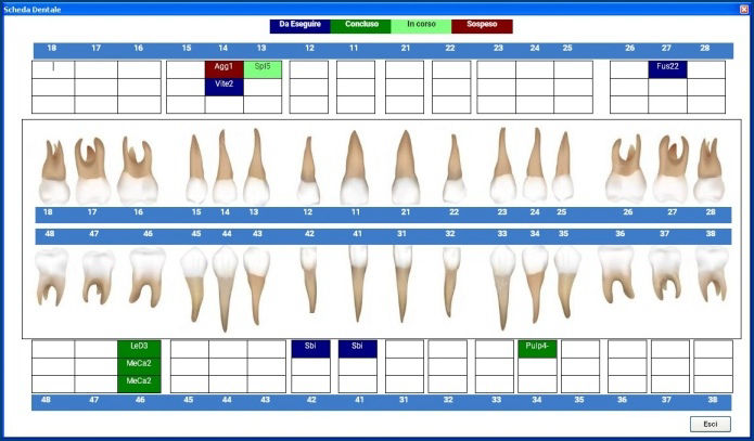 Schema dentale in un software gestionale per studi dentistici