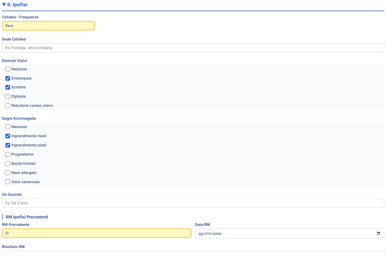 Anamnesi ipofisaria con sospetto adenoma o acromegalia
