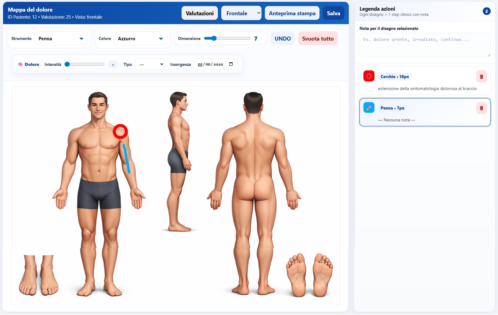 Mappa del dolore interattiva in X-Fisiolab Cloud con body chart anatomica e localizzazione delle aree sintomatiche